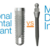 Implant vs Mini